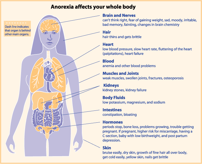 Anorexia Chart